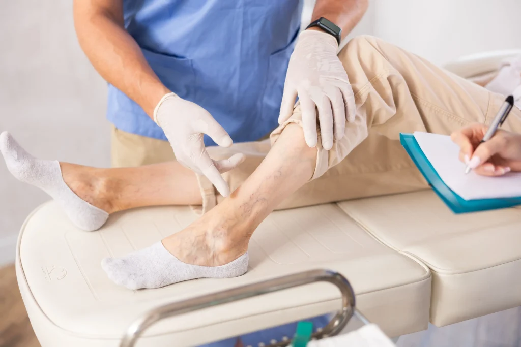 Préserver sa circulation sanguine et garder des jambes jeunes avec l'âge grâce à la phytothérapie